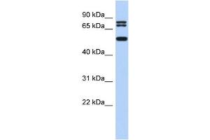 WB Suggested Anti-LASS4 Antibody Titration:  0. (LASS4 Antikörper  (N-Term))