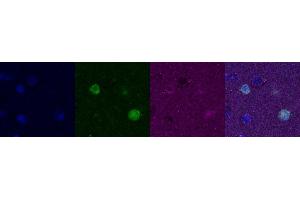 Immunohistochemistry (IHC) image for anti-Calbindin (CALB1) antibody (ABIN7456109) (CALB1 Antikörper)