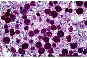 Human Testis: Formalin-Fixed, Paraffin-Embedded (FFPE) (FADS1 Antikörper  (AA 1-100))