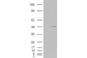 Image no. 2 for anti-Casein Kinase 1, epsilon (CSNK1E) (C-Term) antibody (ABIN374929) (CK1 epsilon Antikörper  (C-Term))