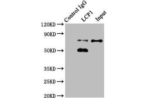 Immunoprecipitating LCP1 in Jurkat whole cell lysate Lane 1: Rabbit control IgG instead of ABIN7163556 in Jurkat whole cell lysate. (LCP1 Antikörper  (AA 2-627))