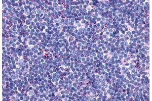 Anti-CCR10 antibody  ABIN1048387 IHC staining of human thymus. (CCR10 Antikörper  (Extracellular Domain))