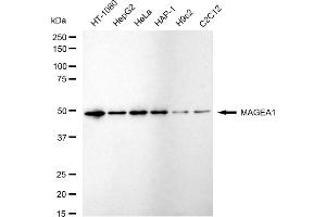 Western blotting analysis using MAGEA1 antibody (ABIN7799356).