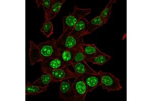 Confocal Immunofluorescence of HeLa cells Ki67 Mouse Monoclonal Antibody (MKI67/2465). (Ki-67 Antikörper  (AA 2293-2478))