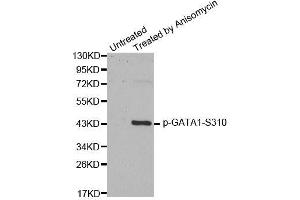 Western blot analysis of extracts from HT29 cells, using Phospho-GATA1-S310 antibody (ABIN2988025). (GATA1 Antikörper  (pSer310))
