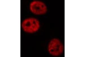 ABIN6277420 staining NIH-3T3 cells by IF/ICC. (PAWR Antikörper  (C-Term))