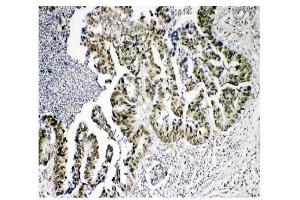 IHC analysis of KDM5B using anti-KDM5B antibody (ABIN4886648). (KDM5B Antikörper  (Middle Region))
