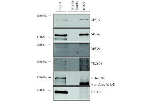 Immunoprecipitation analysis using Mouse Anti-VPS35 Monoclonal Antibody, Clone 10A8 (ABIN6932982). (VPS35 Antikörper  (Atto 488))