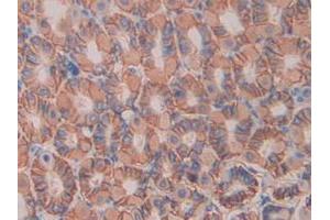 IHC-P analysis of Mouse Stomach Tissue, with DAB staining. (IL11RA Antikörper  (AA 194-329))