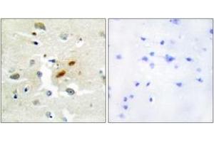 Immunohistochemistry (IHC) image for anti-REV3-Like, Polymerase (DNA Directed), Zeta, Catalytic Subunit (REV3L) (AA 231-280) antibody (ABIN2889337) (REV3L Antikörper  (AA 231-280))