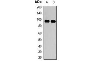 Western blot analysis of STAT5B expression in HepG2 (A), PC12 (B) whole cell lysates. (STAT5B Antikörper)