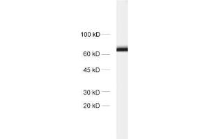 dilution: 1 : 1000, sample: crude synaptosomal fraction of rat brain (P2) (STXBP1 Antikörper)