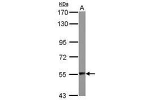 Image no. 2 for anti-Aspartyl-tRNA Synthetase (DARS) (AA 304-501) antibody (ABIN1497768)