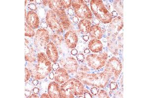 Immunohistochemistry of paraffin-embedded rat kidney using VASP antibody (ABIN6134453, ABIN6150064, ABIN6150065 and ABIN6218508) at dilution of 1:100 (40x lens). (VASP Antikörper  (AA 1-100))