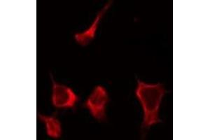 ABIN6268837 staining HepG2 by IF/ICC. (Galectin 9 Antikörper  (Internal Region))