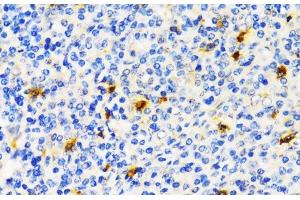 Immunohistochemistry of paraffin-embedded Human tonsil using TIM-3/HAVCR2 Polyclonal Antibody at dilution of 1:200 (40x lens).