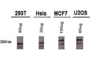 Western blot analysis of BRCA1 using BRCA1 monoclonal antibody, clone MU . (BRCA1 Antikörper  (AA 1314-1864))