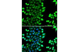 Immunofluorescence analysis of MCF7 cell using RNF7 antibody. (RNF7 Antikörper)