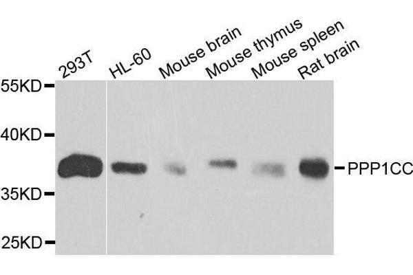 PPP1CC Antikörper  (AA 1-323)
