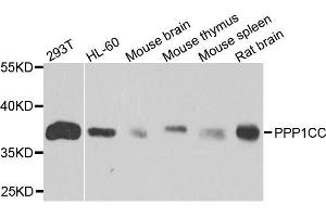 Western blot analysis of extracts of various cell lines, using PPP1CC antibody. (PPP1CC Antikörper  (AA 1-323))