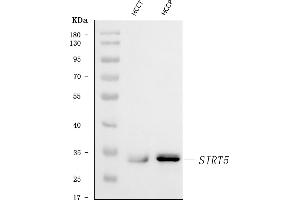 Western blot analysis of SIRT5 using anti-SIRT5 antibody (ABIN7602524).