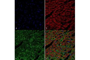 Immunohistochemistry analysis using Mouse Anti-Hexanoyl-Lysine adduct Monoclonal Antibody, Clone 5D9 (ABIN5067246). (Hexanoyl-Lysine Adduct (HEL) Antikörper (Biotin))