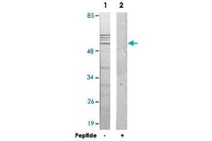 Western blot analysis of extracts from 293 cells, using IP6K3 polyclonal antibody .
