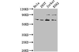Western Blot Positive WB detected in: Hela whole cell lysate, 293T whole cell lysate, Jurkat whole cell lysate, K562 whole cell lysate All lanes: ALG9 antibody at 6. (ALG9 Antikörper  (AA 434-618))
