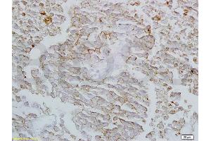 Formalin-fixed and paraffin embedded rat lung labeled with Anti-Claudin-4 Polyclonal Antibody, Unconjugated (ABIN680743) at 1:200 followed by conjugation to the secondary antibody and DAB staining (Claudin 4 Antikörper  (AA 21-120))