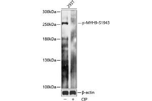 Western blot analysis of extracts of 293T cells, using Phospho-MYH9-S1943 antibody (ABIN7268744) at 1:2000 dilution. (Myosin 9 Antikörper  (pSer1943))