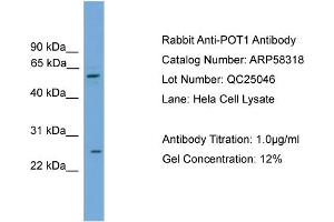 WB Suggested Anti-POT1  Antibody Titration: 0. (POT1 Antikörper  (Middle Region))