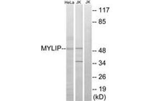 Western blot analysis of extracts from HeLa/Jurkat cells, using MYLIP Antibody. (MYLIP Antikörper  (AA 161-210))