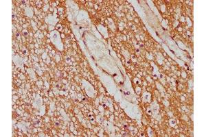 IHC image of ABIN7142186 diluted at 1:600 and staining in paraffin-embedded human brain tissue performed on a Leica BondTM system. (CYP7B1 Antikörper  (AA 312-430))