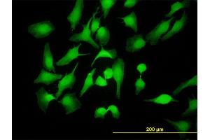Immunofluorescence of monoclonal antibody to PBK on HeLa cell. (PBK Antikörper  (AA 1-110))