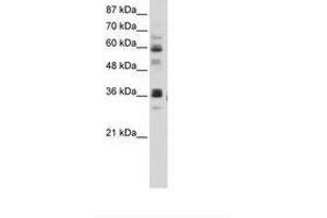 Image no. 2 for anti-RNA Pseudouridylate Synthase Domain Containing 2 (RPUSD2) (AA 201-250) antibody (ABIN202743) (RPUSD2 Antikörper  (AA 201-250))