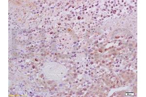 Formalin-fixed and paraffin embedded mouse lymphoma tissue labeled with Anti-Dnmt1 Polyclonal Antibody, Unconjugated (ABIN671796) at 1:200, followed by conjugation to the secondary antibody and DAB staining