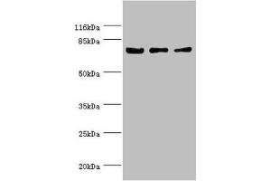 Western blot All lanes: KLC1 antibody at 1. (KLC1 Antikörper  (AA 274-573))