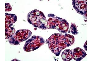 Human Placenta: Formalin-Fixed, Paraffin-Embedded (FFPE) (TUBA4A Antikörper  (AA 426-450))