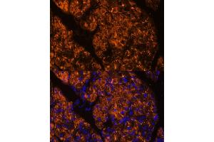 Immunofluorescence analysis of rat pancreas using SERPINI2 Polyclonal Antibody (ABIN6131321, ABIN6147617, ABIN6147618 and ABIN6215429) at dilution of 1:100 (40x lens). (SERPINI2 Antikörper  (AA 56-405))