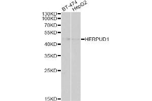 Western blot analysis of extracts of various cell lines, using HERPUD1 antibody.