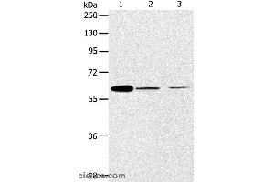 Western blot analysis of NIH/3T3 and SKOV3 cell, human ovarian cancer tissue, using ABCE1 Polyclonal Antibody at dilution of 1:450 (ABCE1 Antikörper)