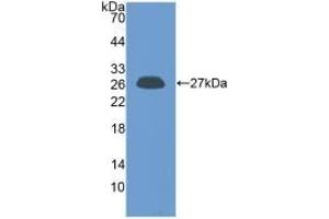 Detection of Recombinant PRL, Human using Polyclonal Antibody to Prolactin (PRL) (Prolactin Antikörper  (AA 29-227))