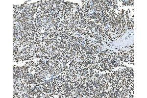 IHC analysis of Glycine decarboxylase/GLDC using anti-Glycine decarboxylase/GLDC antibody (ABIN7602073).