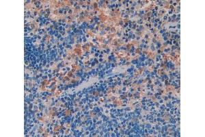 Used in DAB staining on fromalin fixed paraffin- embedded Kidney tissue (WASP Antikörper  (AA 39-251))
