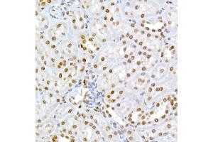 Immunohistochemistry of paraffin-embedded rat kidney using Phospho-RB-S795 Rabbit pAb (ABIN3023606, ABIN3023607, ABIN3023608 and ABIN6225464) at dilution of 1:50 (40x lens). (Retinoblastoma 1 Antikörper  (pSer795))