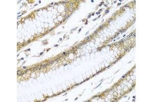 Immunohistochemistry of paraffin-embedded Human stomach using GNAI3 Polyclonal Antibody at dilution of 1:100 (40x lens). (GNAI3 Antikörper)