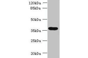 Western blot All lanes: TRIM51 antibody at 1.