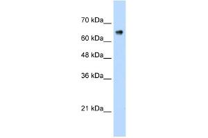 WB Suggested Anti-ZNF326 Antibody Titration:  0. (ZNF326 Antikörper  (C-Term))