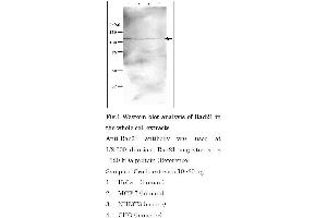 Western Blotting (WB) image for anti-RAD21 Homolog (RAD21) (C-Term) antibody (ABIN2452087)