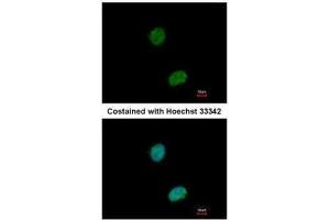 ICC/IF Image Immunofluorescence analysis of paraformaldehyde-fixed HeLa, using Ataxin 3, antibody at 1:500 dilution. (Ataxin 3 Antikörper)
